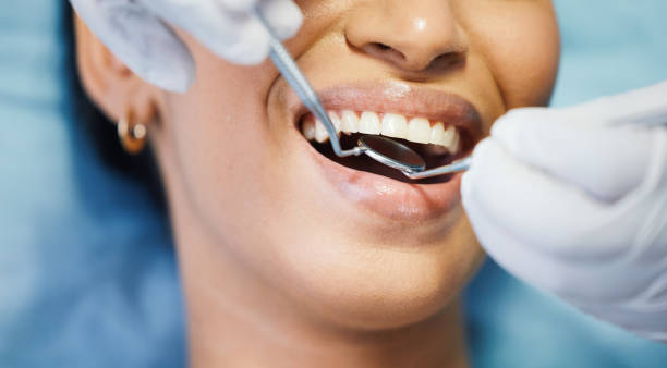 Best Emergency Tooth Extraction in Gruetli Laager, TN